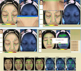 3D Dermatologia Maszyna do analizy skóry twarzy Skaner twarzy Analizator skóry 40W