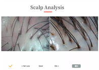 3 Spectrum Scalp Analyzer Detektor Przenośny mieszek włosowy skóry głowy 720P 1080P