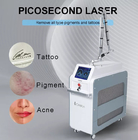 755nm Mole Picosecond Laser Machine Usuwanie piegów laserowych Co2